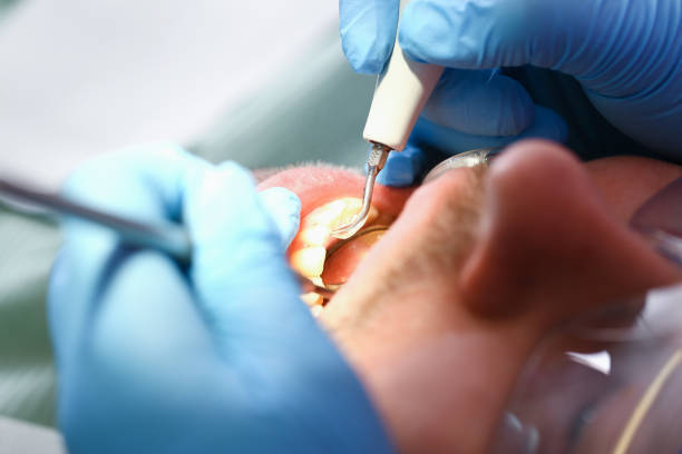 Best Emergency Cosmetic Dentistry in Dade City North, FL