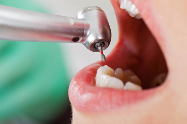 Best Broken or Cracked Tooth Emergency Dentist in Dade City North, FL